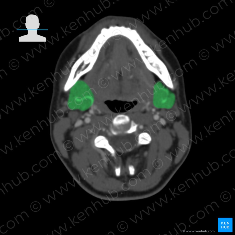 Submandibular gland (Glandula submandibularis); Image: 