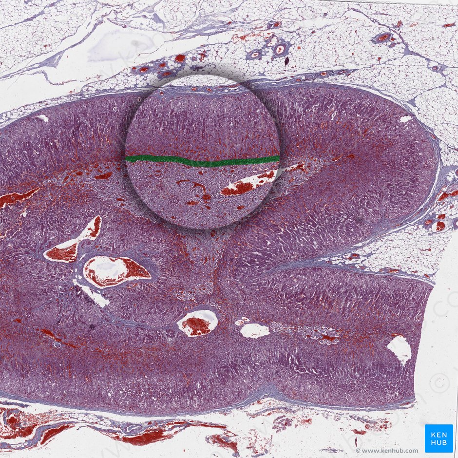 Unión corticomedular (Junctio corticomedullaris); Imagen: 