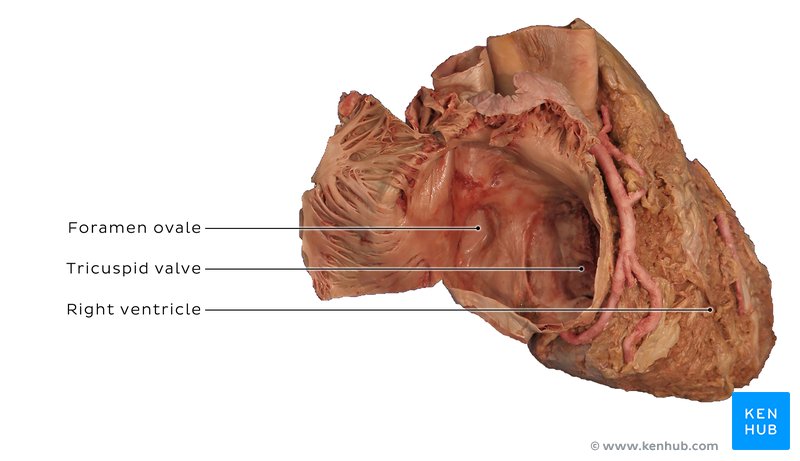 Right atrioventricular (tricuspid) valve in a cadaver