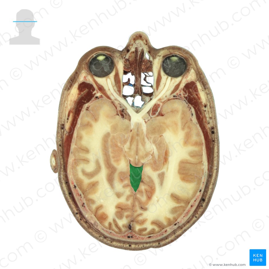 Vermis of cerebellum (Vermis cerebelli); Image: National Library of Medicine