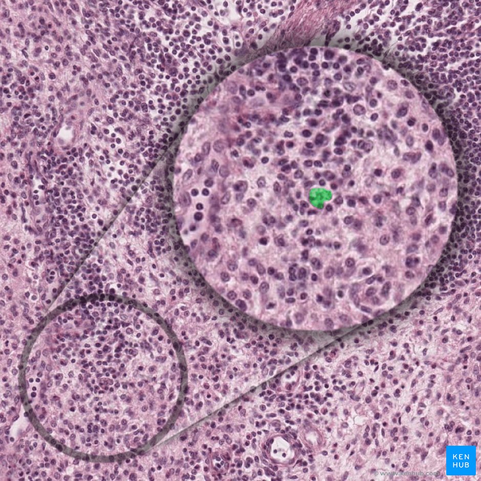 Macrófago (Macrophagocytus); Imagen: 