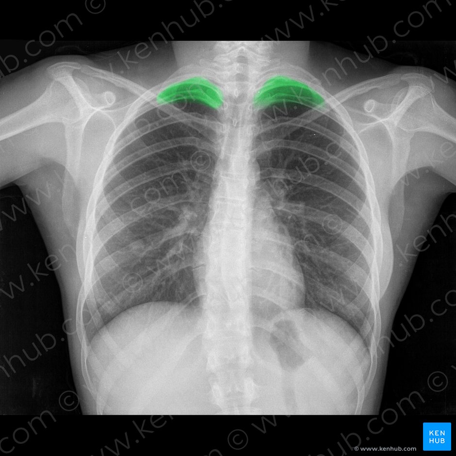 Apex of lung (Apex pulmonis); Image: 