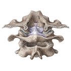 Uncovertebral Artroza articulației uncovertrale