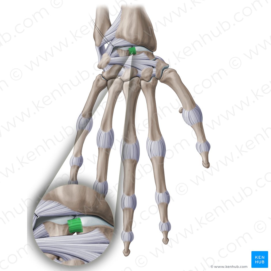 Scapholunate interosseous ligament (Ligamentum scapholunatum interosseum); Image: Paul Kim