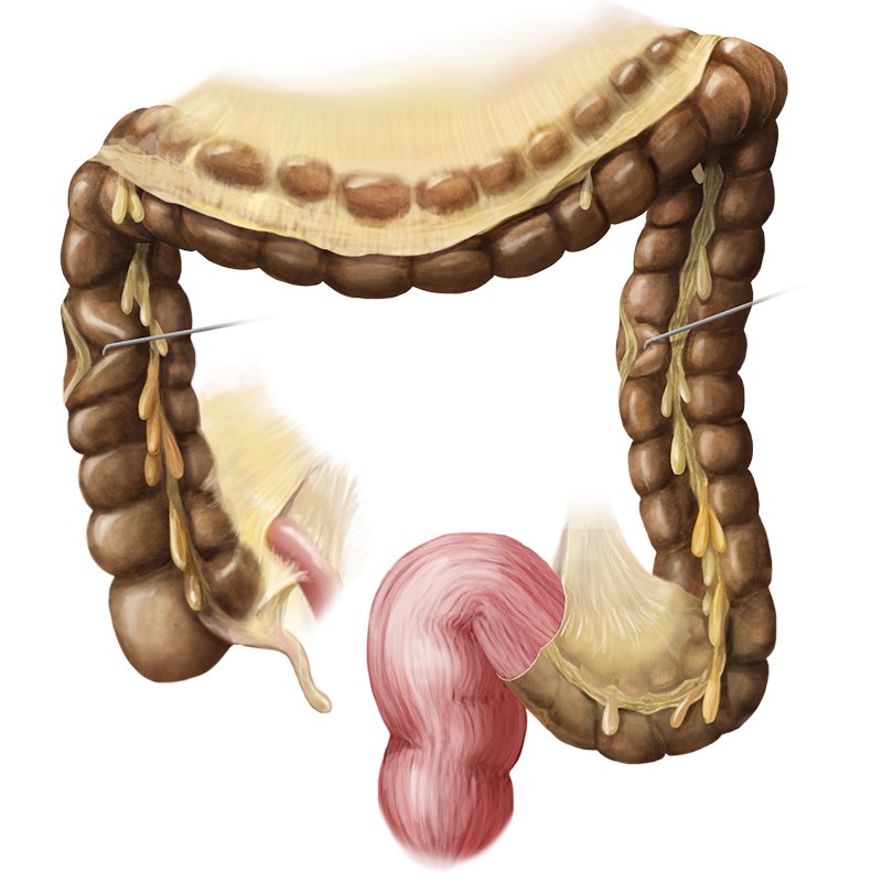 Large intestine (Anatomy) - Study Guide | Kenhub