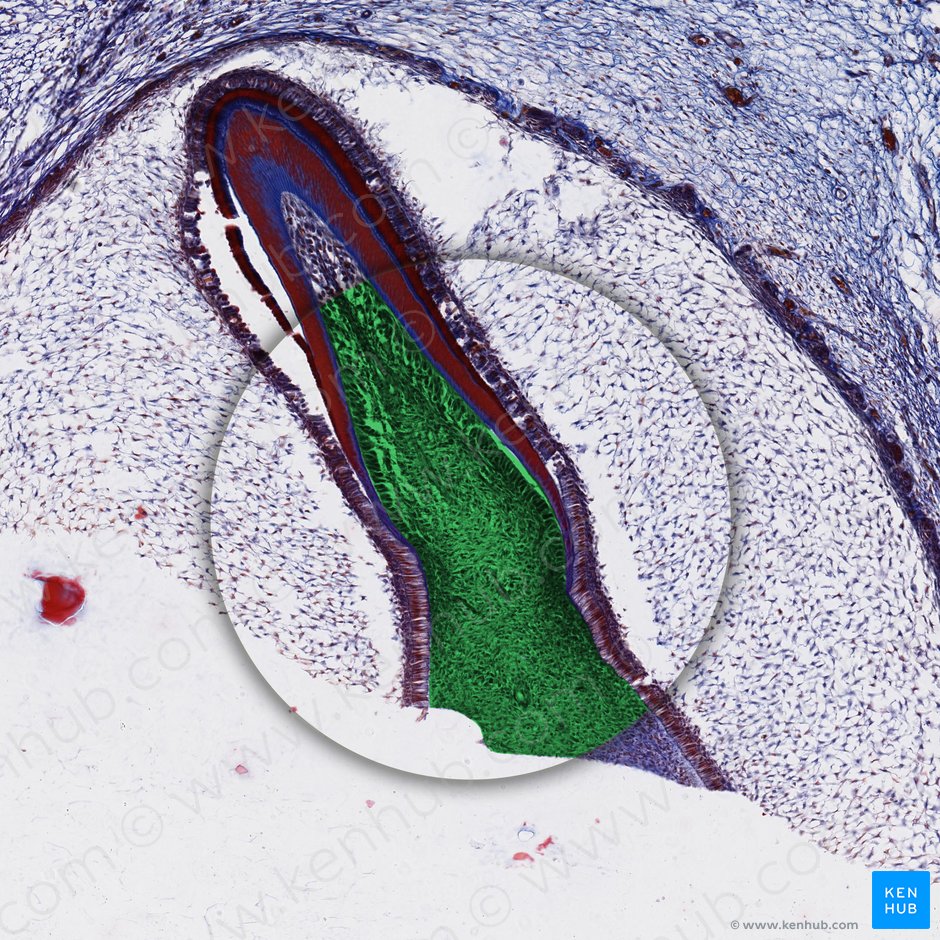 Mucoid connective tissue; Image: 