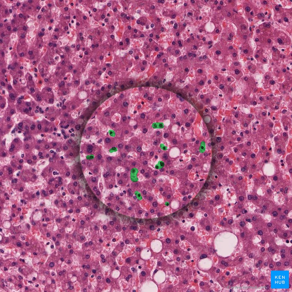 Células estrelladas hepáticas (Cellula perisinusoidalis); Imagen: 