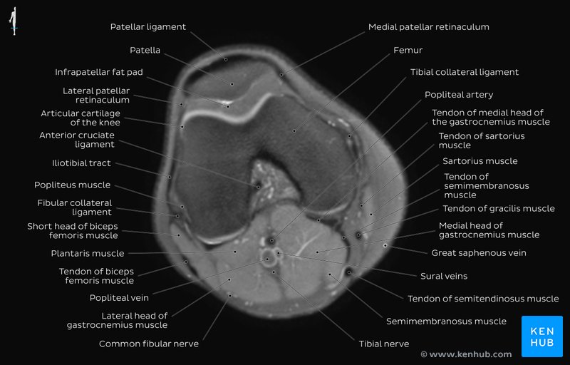 Radiological anatomy : X-ray, CT, MRI | Kenhub