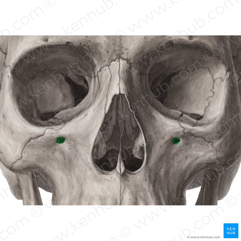 Infraorbital foramen of maxilla (Foramen infraorbitale maxillae); Image: Yousun Koh