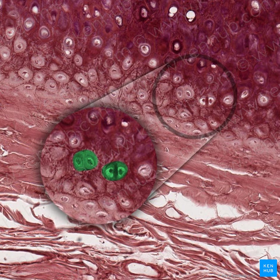 Grupo isógeno de condrocitos (Aggregatio isogenica chondrocyti); Imagen: 