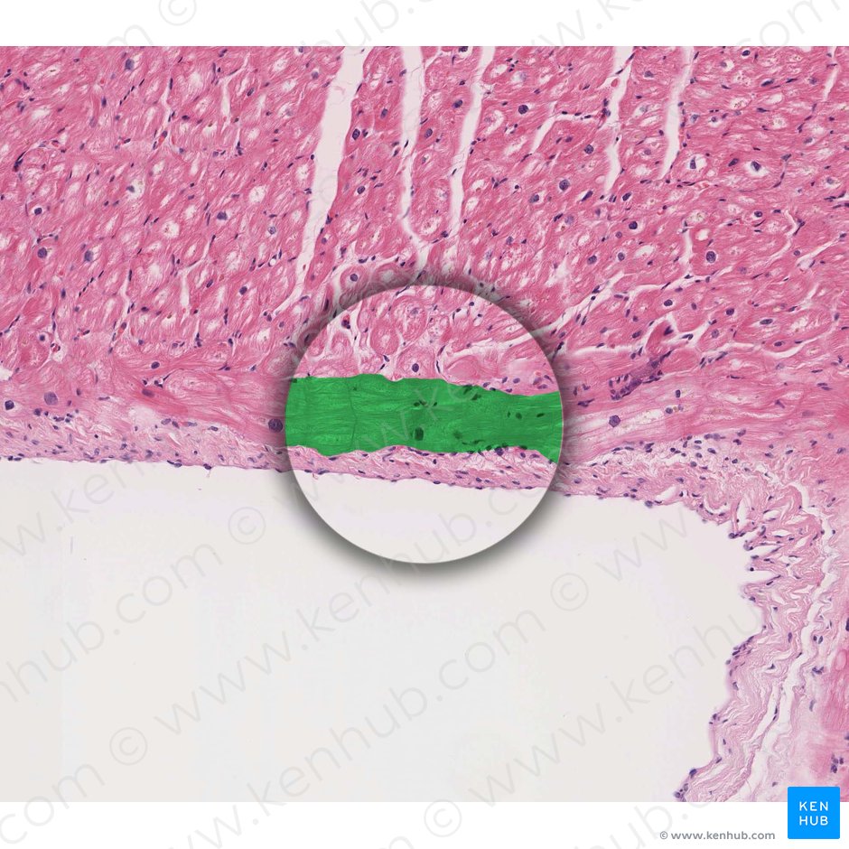 Neurofibrae purkinjensia (Bündel von Purkinje-Fasern); Bild: 
