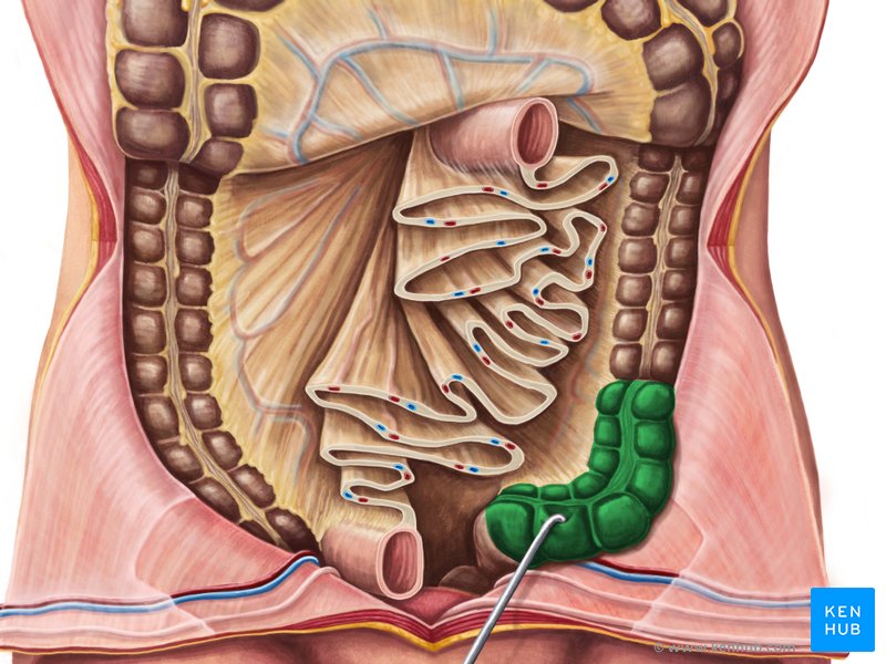 Sigmoid colon - Definition, Anatomy and Function | Kenhub