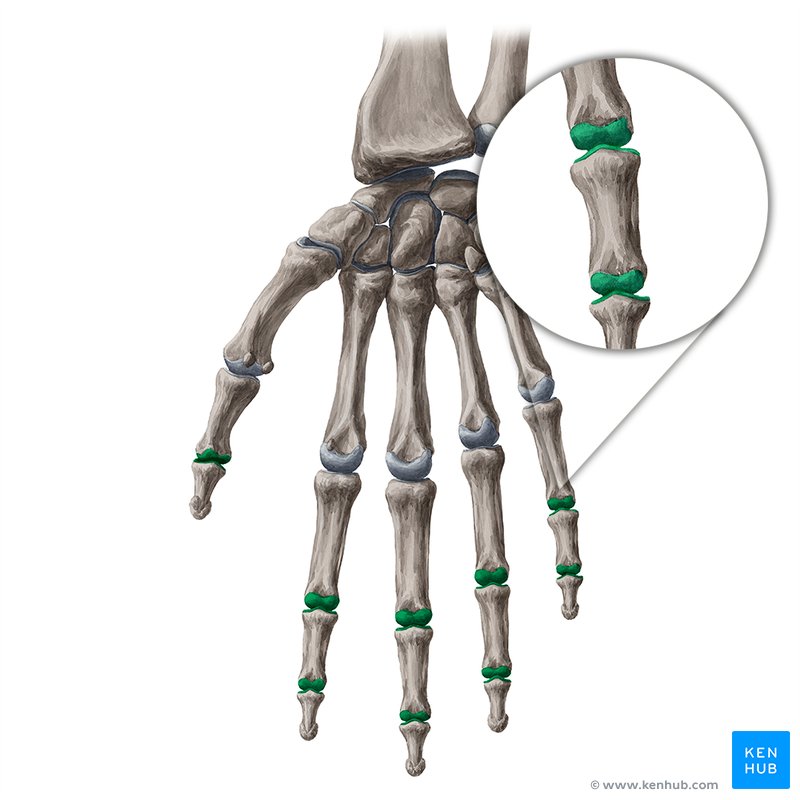 Artrita articulației interfalangiene proximale - Reumatologia si bolile reumatice