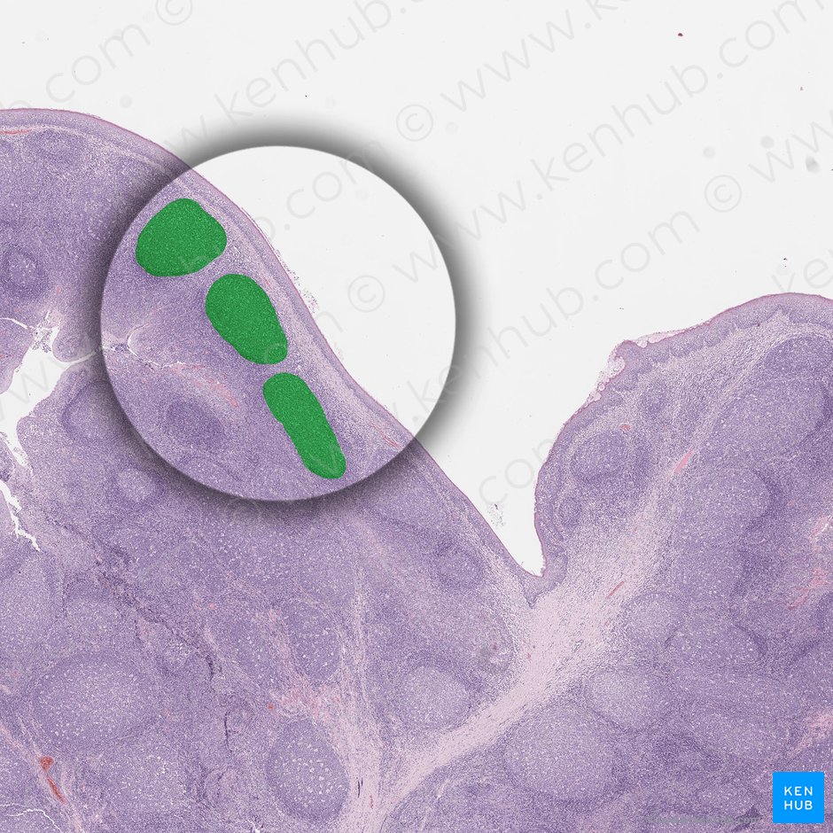 Lymphoid nodule (Nodulus lymphoideus); Image: 