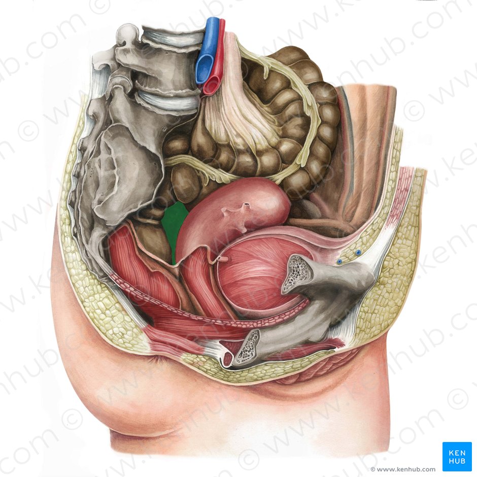 Fondo de saco recto-uterino (Excavatio rectouterina); Imagen: Irina Münstermann