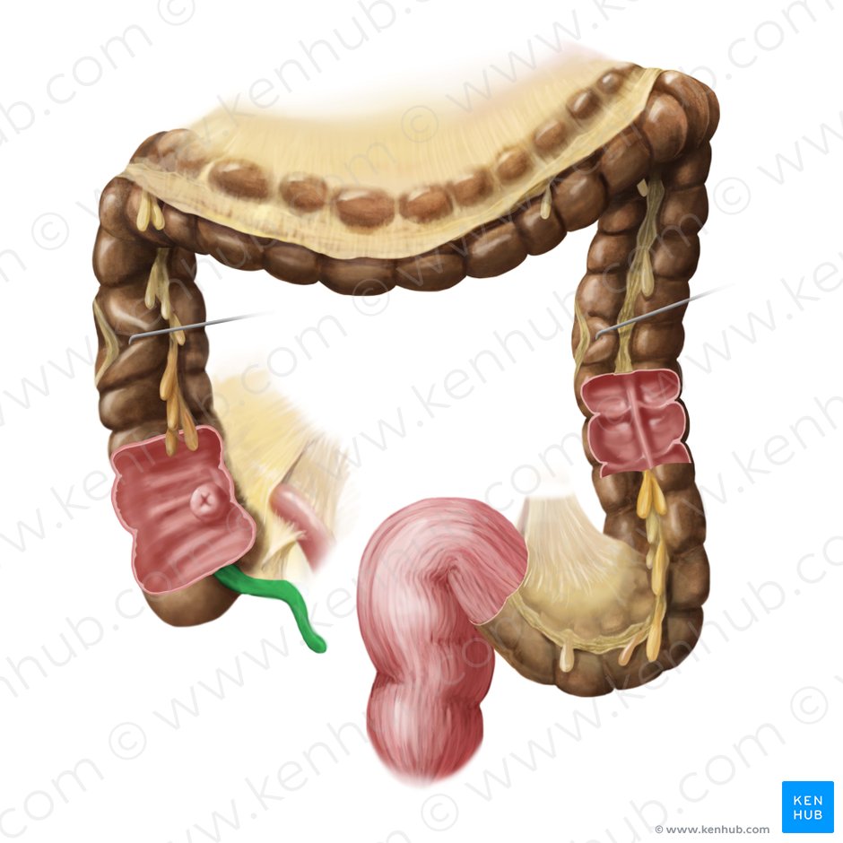Apêndice vermiforme (Appendix vermiformis); Imagem: Begoña Rodriguez