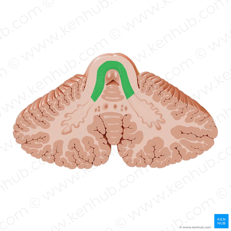 Superior cerebellar peduncle (Pedunculus cerebellaris superior); Image: Paul Kim