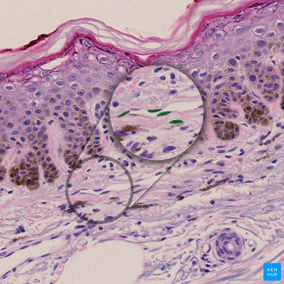Fibrocito (Fibrocytus); Imagen: 