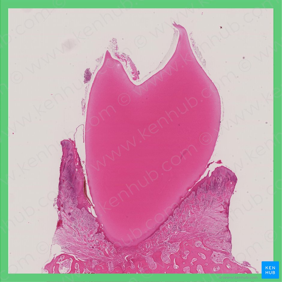 Adult tooth; Image: 