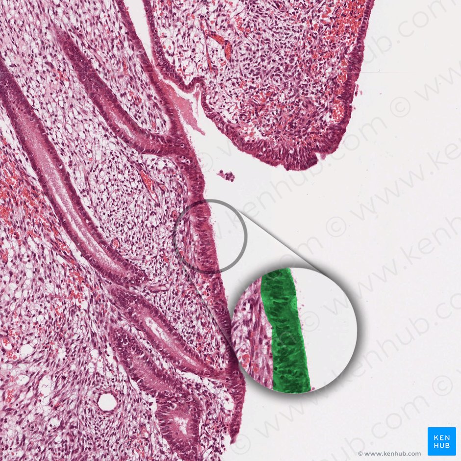 Epitelio columnar simple del endometrio; Imagen: 