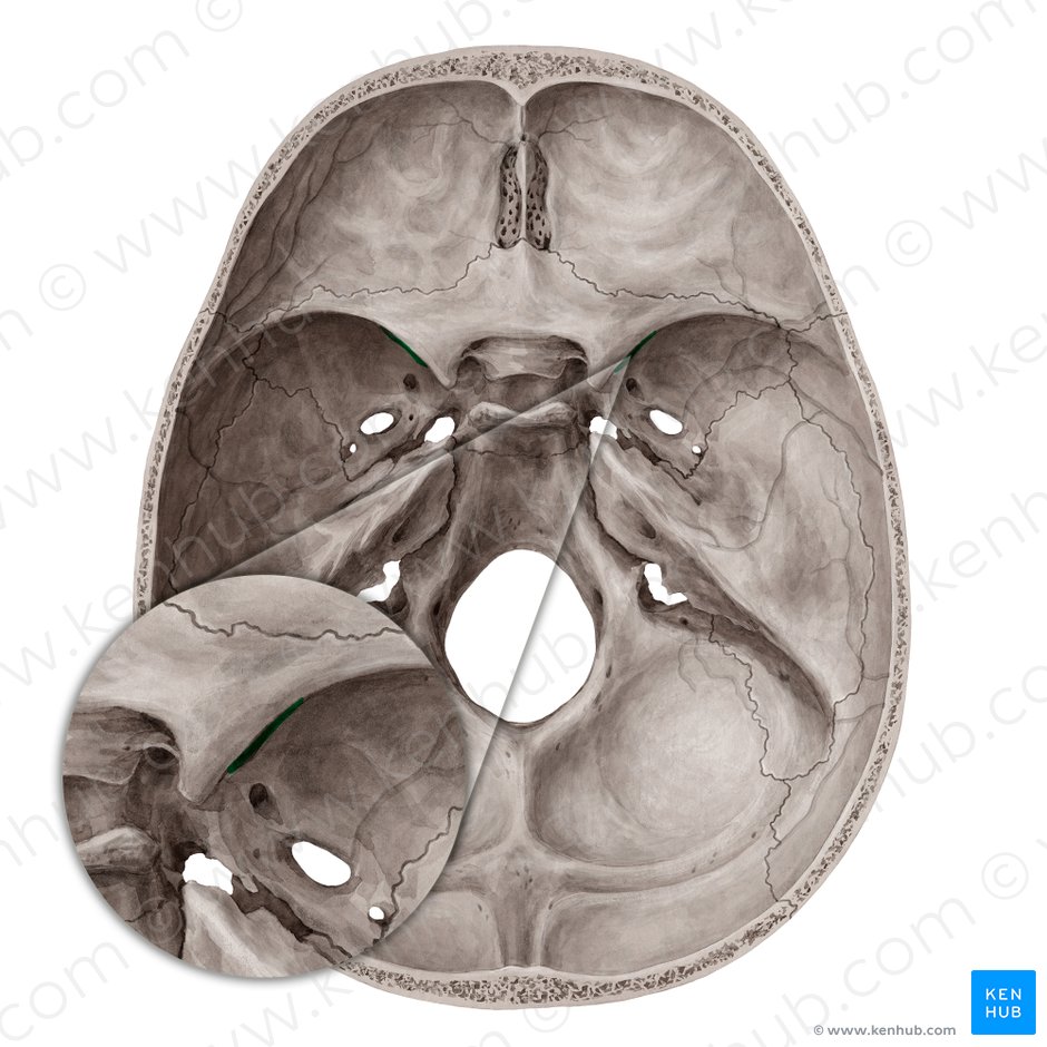Fissura orbitalis superior (Obere Augenhöhlenspalte); Bild: Yousun Koh