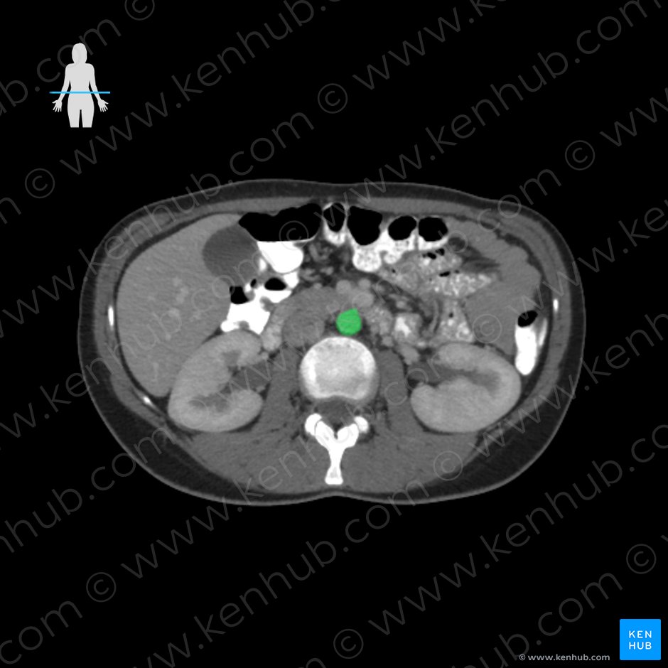Abdominal aorta (Aorta abdominalis); Image: 