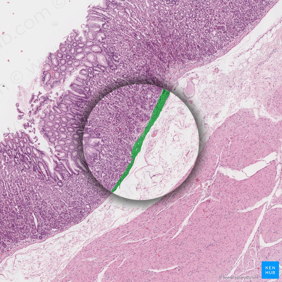 Muscularis mucosae (Lamina muscularis mucosae); Image: 