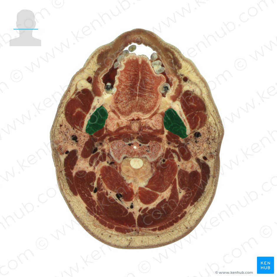 Músculo pterigóideo medial (Musculus pterygoideus medialis); Imagem: National Library of Medicine