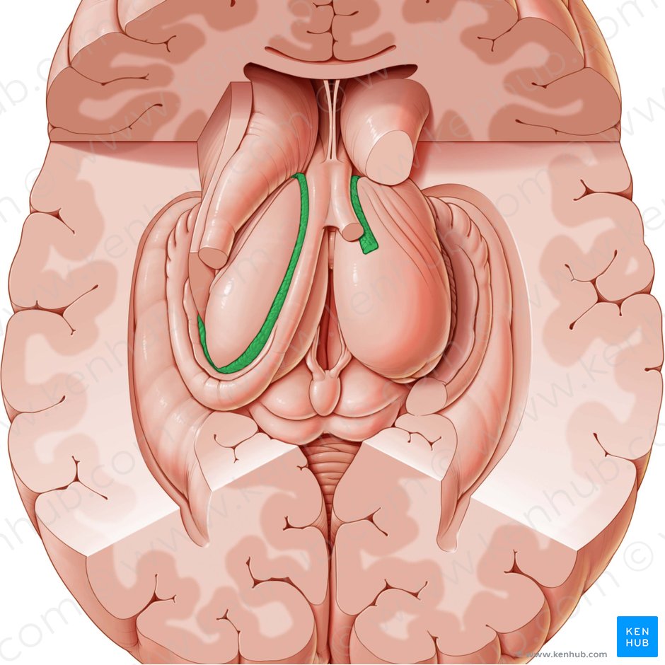 Plexus choroideus ventriculi lateralis (Adergeflecht des Seitenventrikels); Bild: Paul Kim