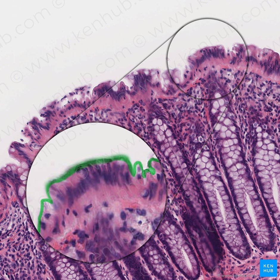 Microvillous border of colonocyte (Limbus microvillosus colonocyti); Image: 