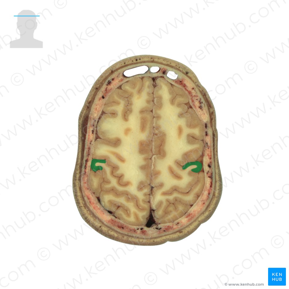 Postcentral gyrus (Gyrus postcentralis); Image: National Library of Medicine
