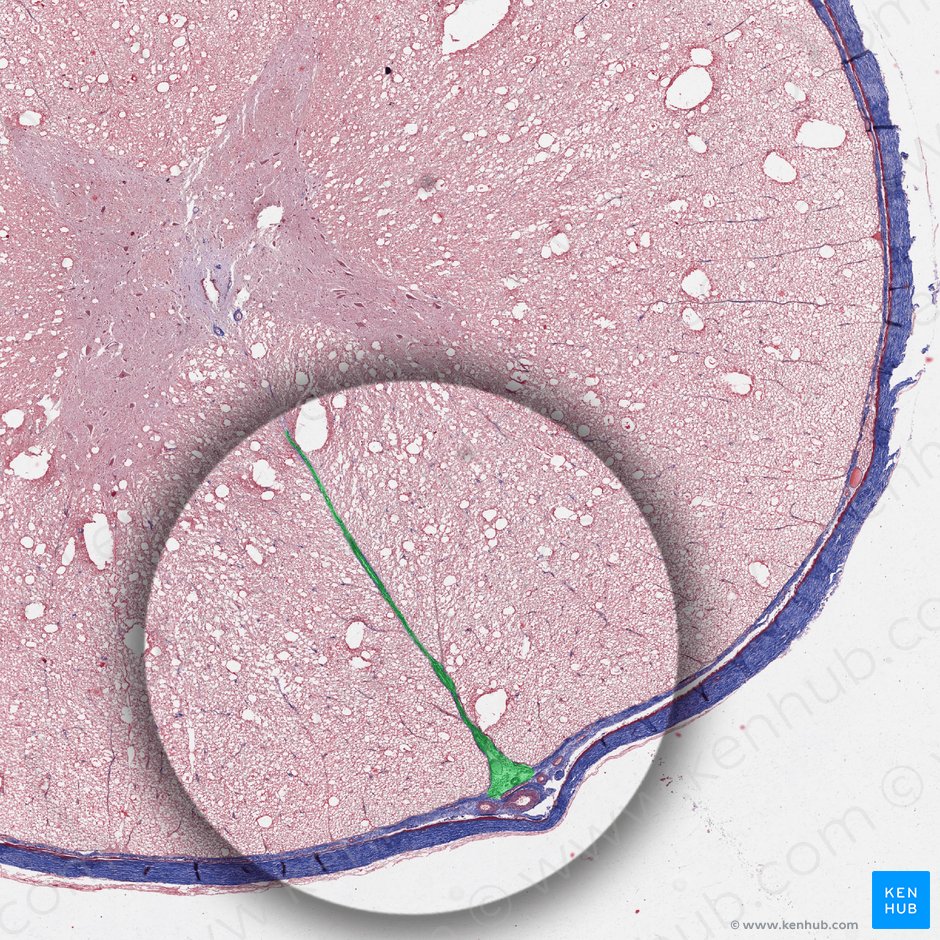 Fissura mediana anterior medullae spinalis (Vordere mediane Spalte des Rückenmarks); Bild: 