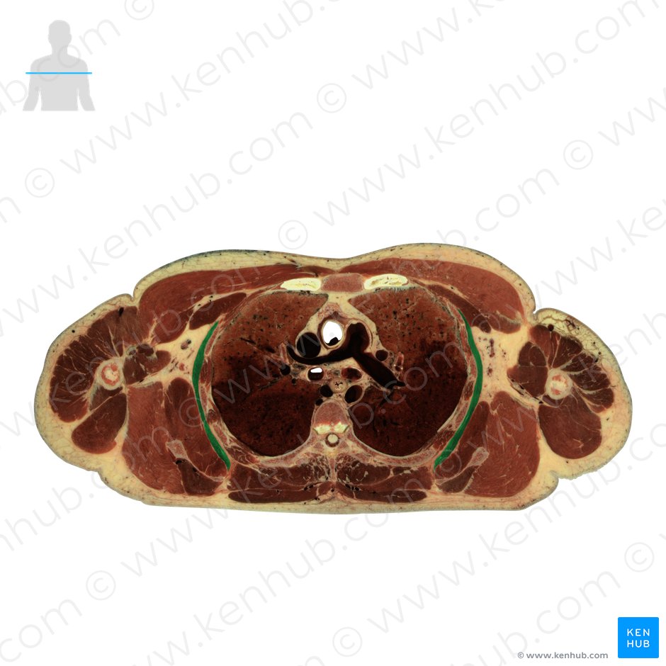 Músculo serrátil anterior (Musculus serratus anterior); Imagem: National Library of Medicine