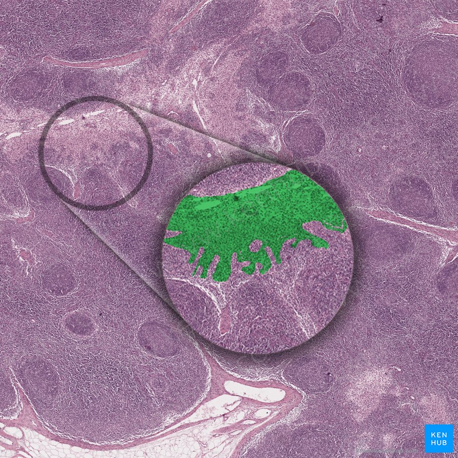 Medullary sinuses (Sinus lymphatici medullares); Image: 