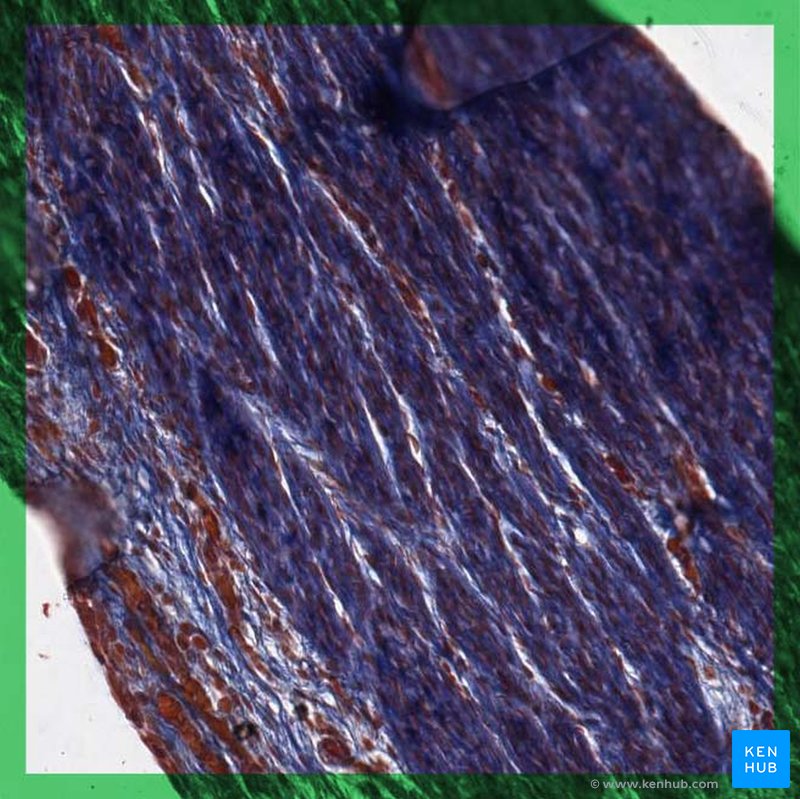 Dense connective tissue: Cells, fibers and types | Kenhub