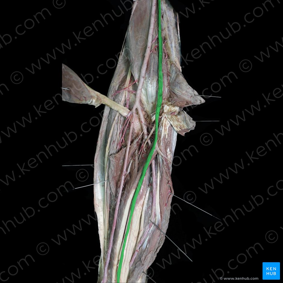 Median nerve (Nervus medianus); Image: 