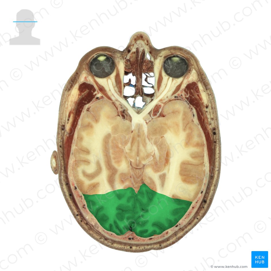 Lobo occipital (Lobus occipitalis); Imagem: National Library of Medicine