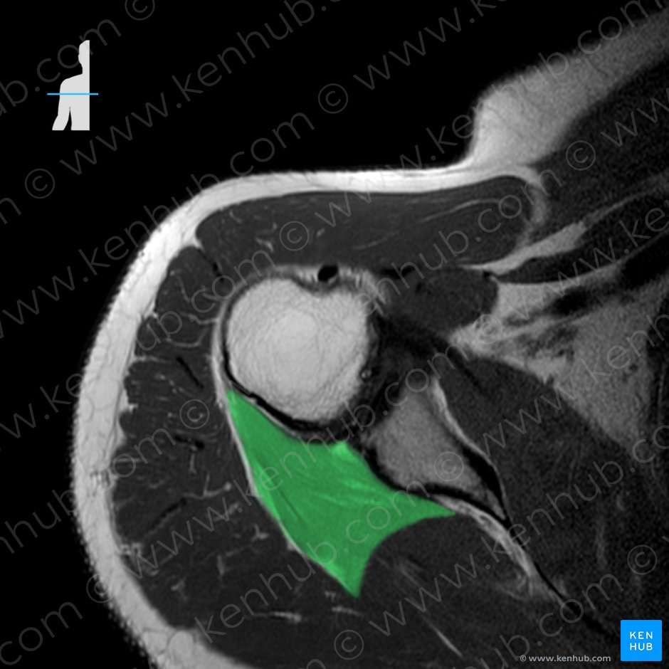 Teres minor muscle (Musculus teres minor); Image: 