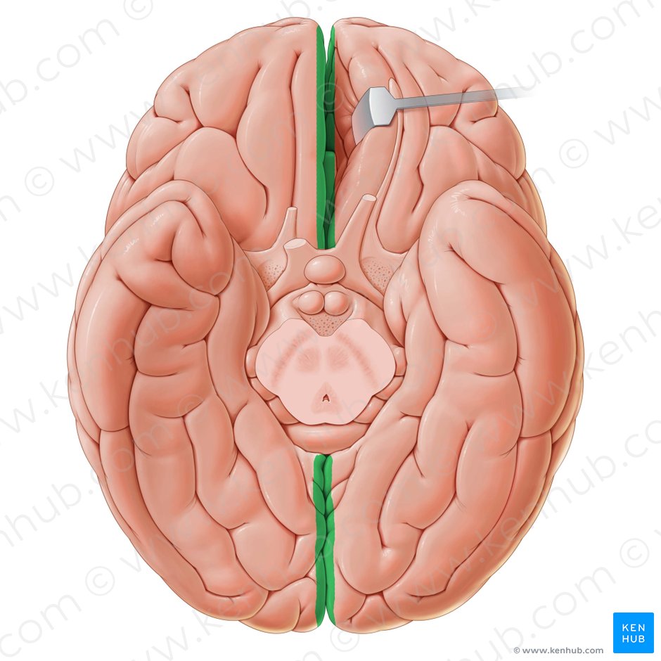 Longitudinal cerebral fissure (Fissura longitudinalis cerebri); Image: Paul Kim