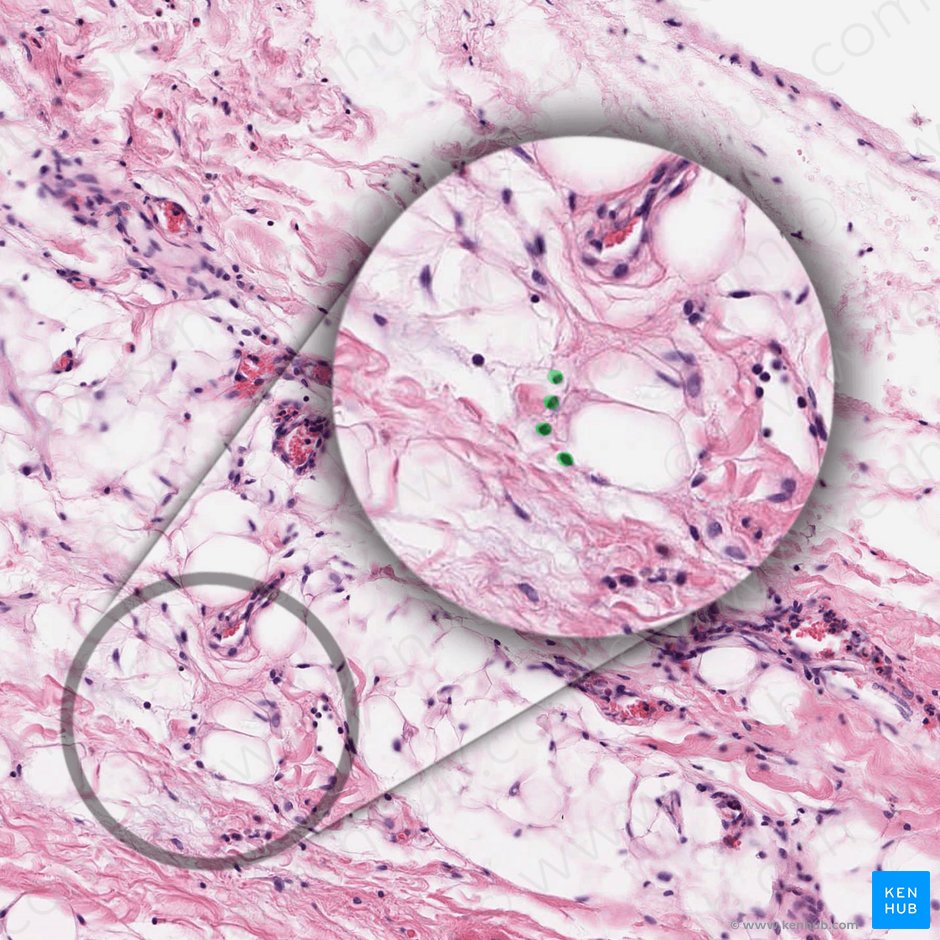 Fibrocyte (Fibrocytus); Image: 