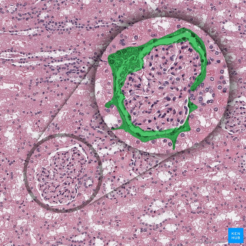 Glomerular capsule (Capsula glomerularis); Image: 