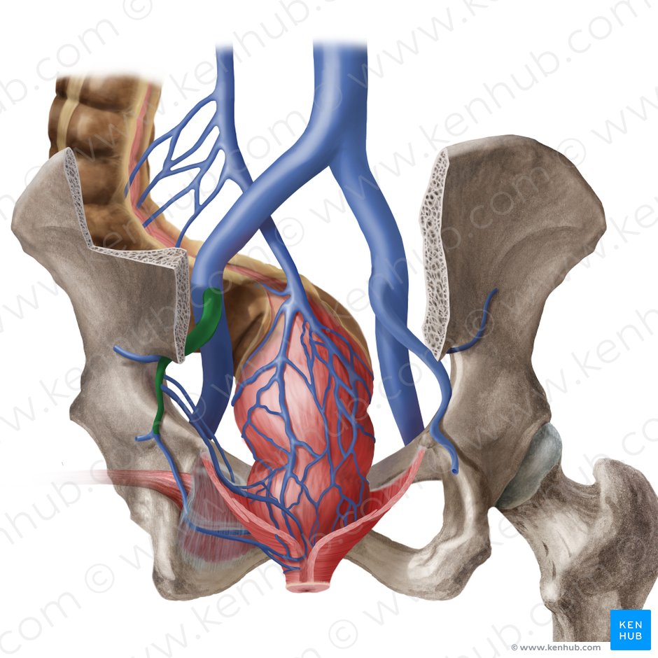 Left internal iliac vein (Vena iliaca interna sinistra); Image: Begoña Rodriguez