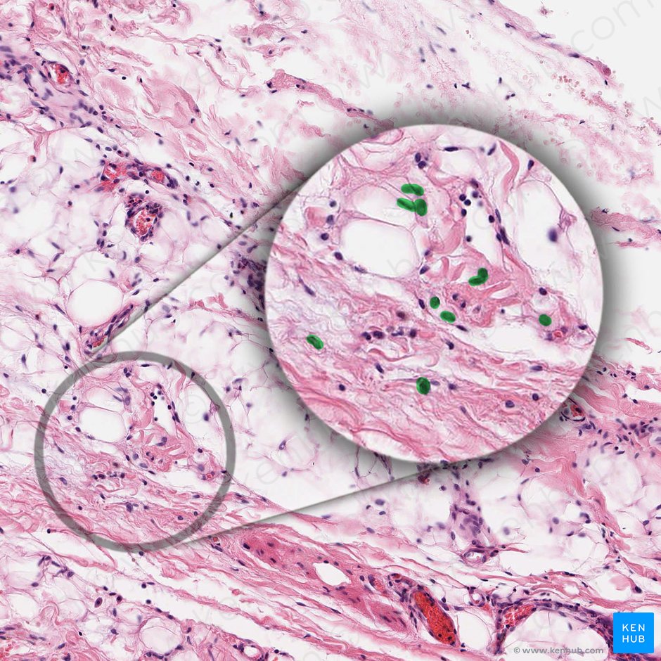 Fibroblasto (Fibroblastus); Imagen: 
