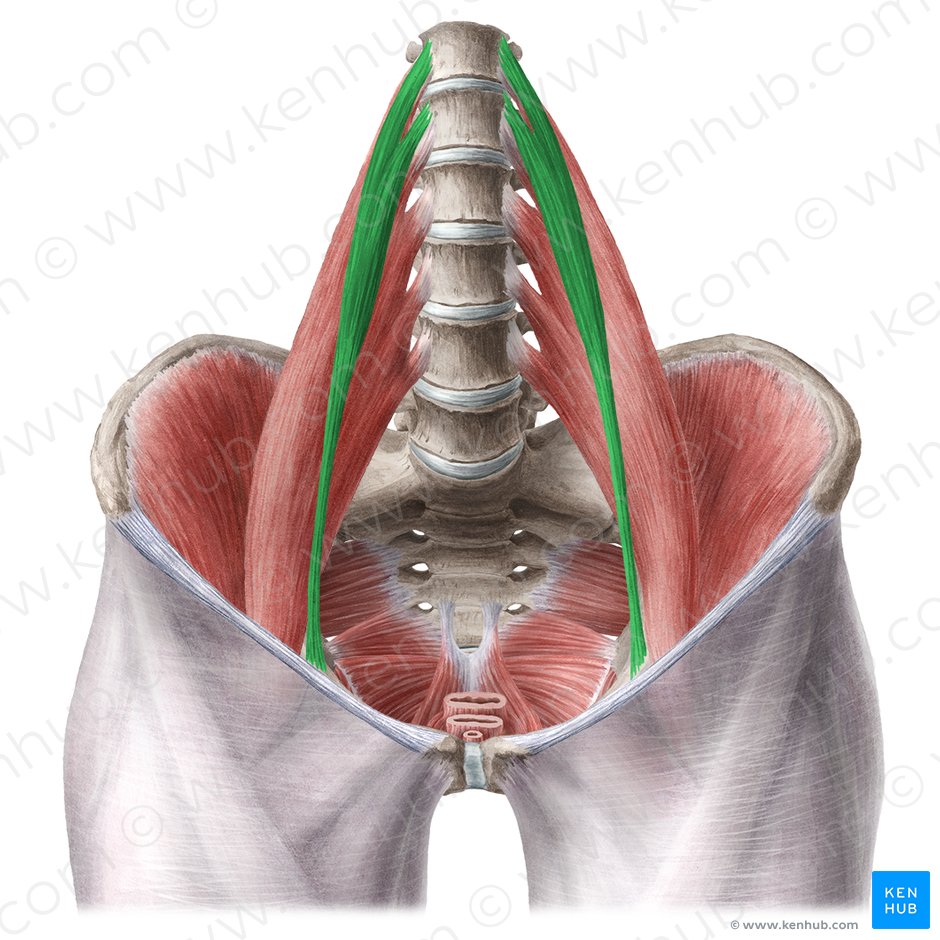 Musculus psoas minor (Kleiner Lendenmuskel); Bild: Liene Znotina