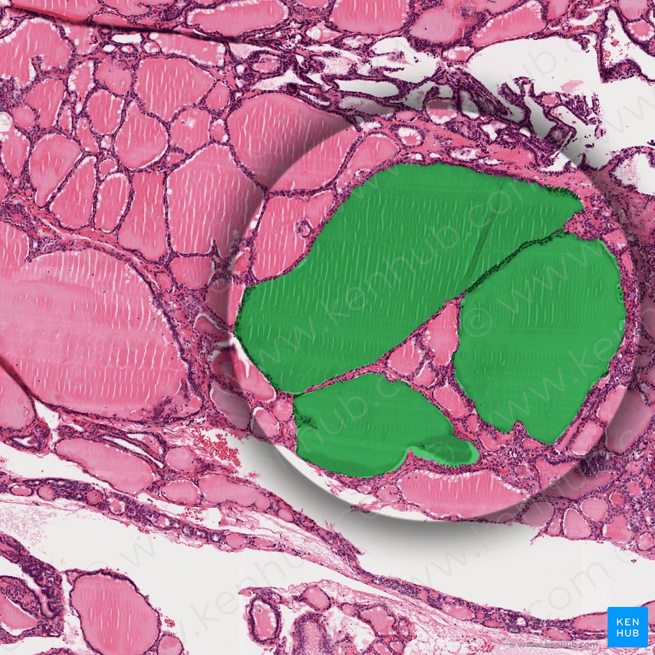 Thyroid follicle (Folliculus thyroideus); Image: 
