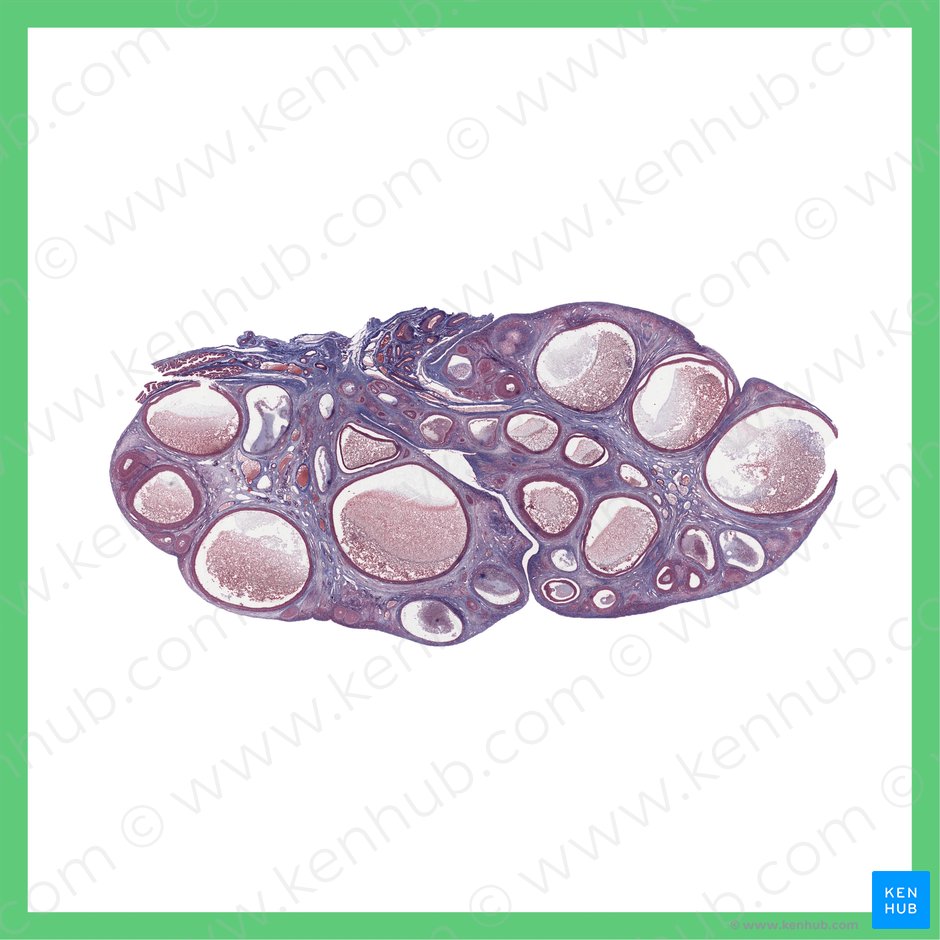 Fase ovulatoria del ovario (Ovarium (phasis ovulatoria)); Imagen: 