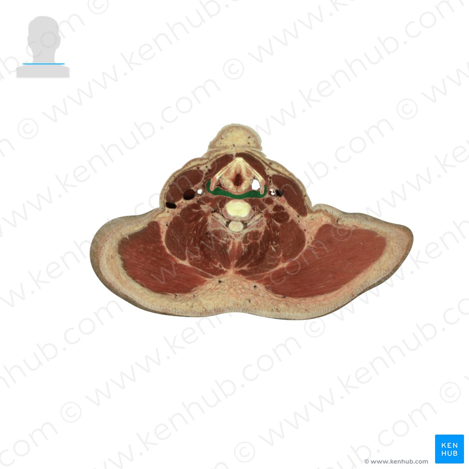 Músculo constritor inferior da faringe (Musculus constrictor inferior pharyngis); Imagem: National Library of Medicine