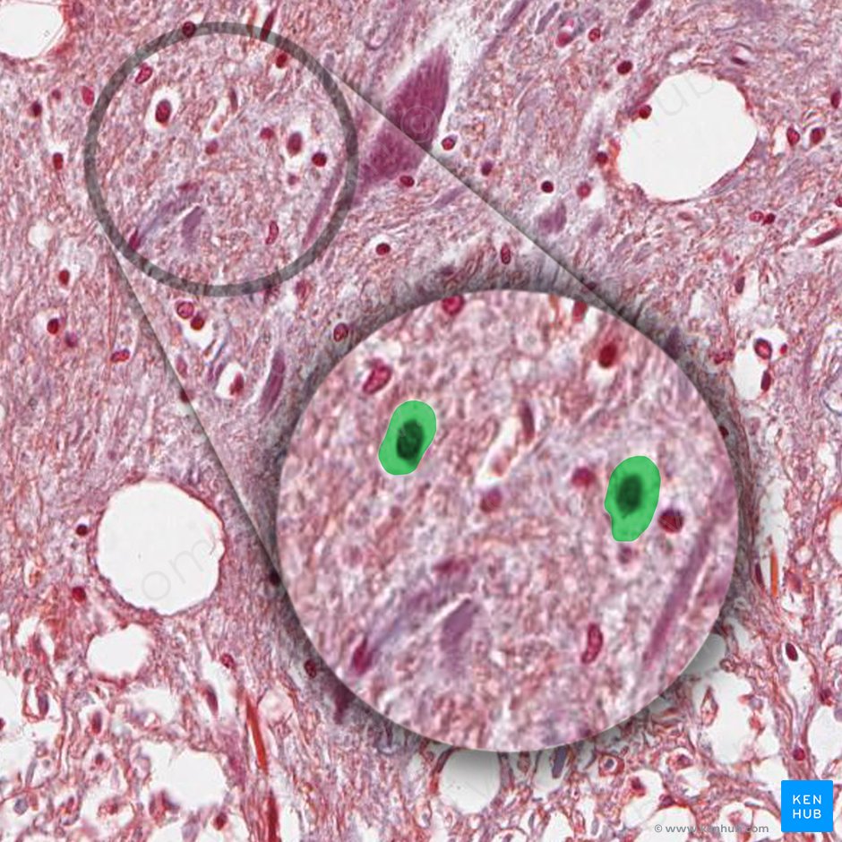 Oligodendrocytus (Oligodendrozyt); Bild: 