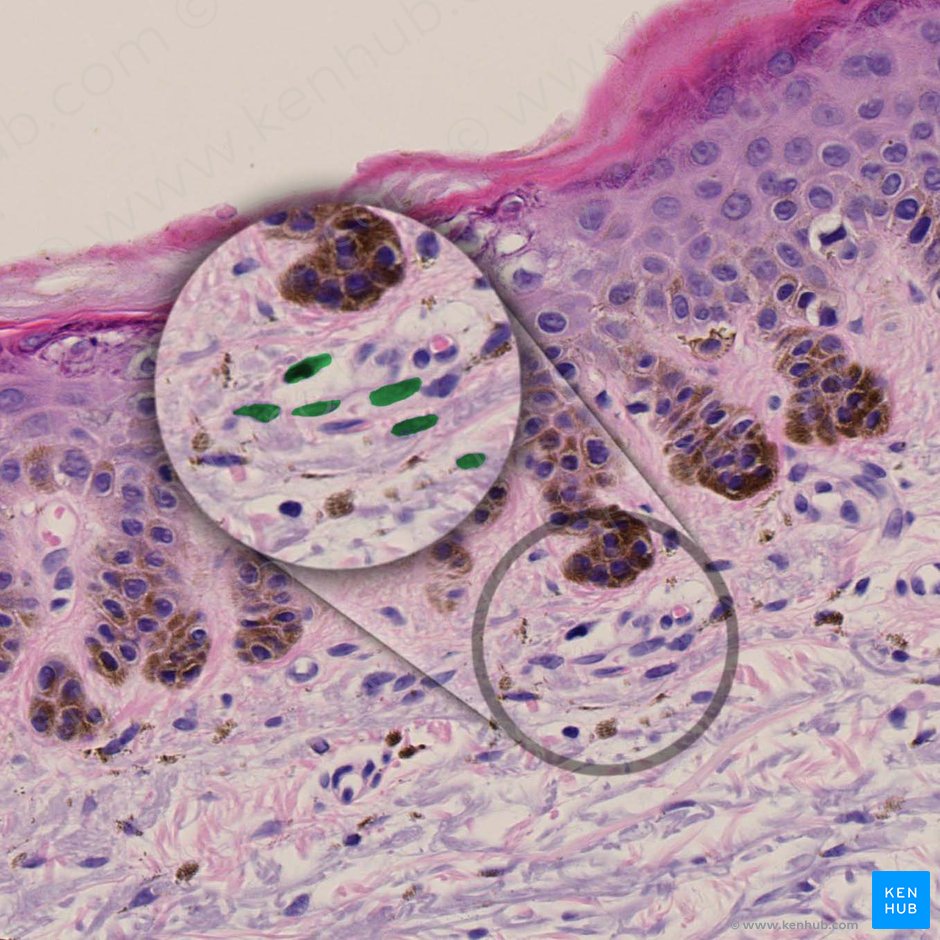 Fibroblastus (Fibroblast); Bild: 