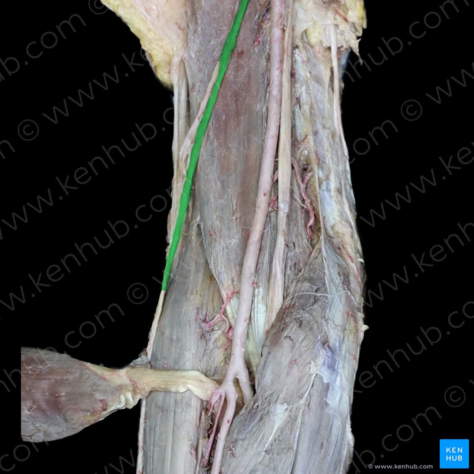 Musculocutaneous nerve (Nervus musculocutaneus); Image: 